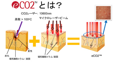 eCO2とは？