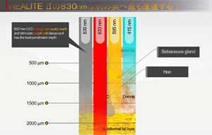 HEALITEⅡの830nmは肌の奥へ最も進達する！