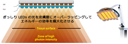 ぎっしりLEDsの光を皮膚層にオーバーラッピングしてエネルギーの効率を極大化させる