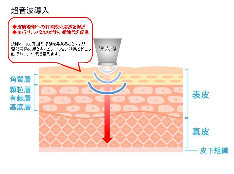 超音波導入